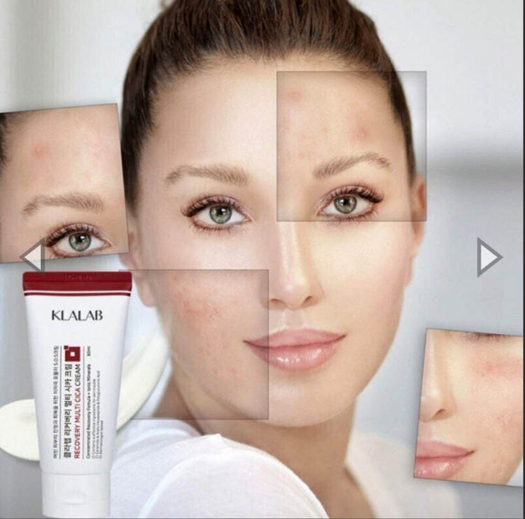 Klalab Recovery Multi Cica Cream 80 ml کرم ترمیم کننده و ریکاوری سیکا کلالب😍 ۸۰ میل تاریخ ۲۰۲۸ مناسب انواع پوست و بریر آسیب دیده