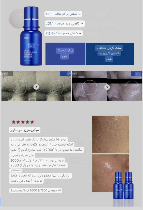اگزوم شات برند مدیکیوب ۳۰ میل تاریخ ۵/۲۰۲۷
